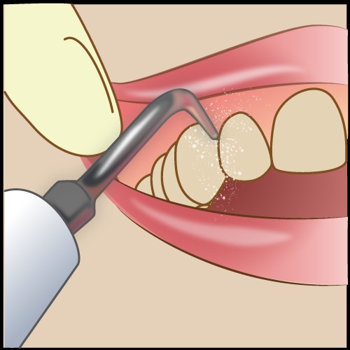 f:id:luismiquel:20190616002100j:image