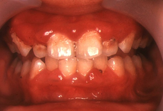 f:id:luismiquel:20190616004831j:image