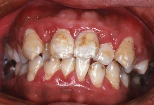 f:id:luismiquel:20190616004913j:image