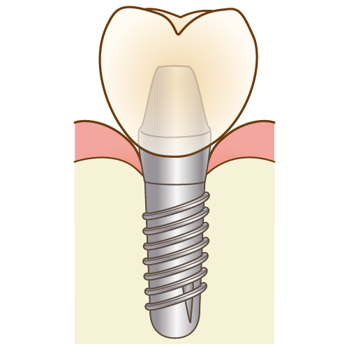 f:id:luismiquel:20200622130411p:plain