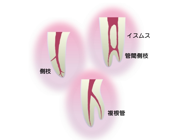 f:id:luismiquel:20200625221713p:plain