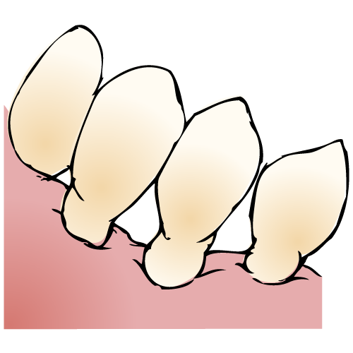 f:id:luismiquel:20200706135142p:plain